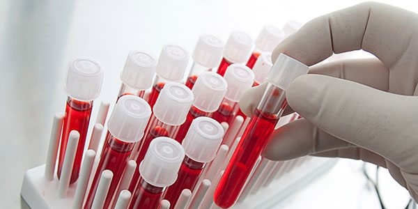 0 kan grubuna sahip olan kişiler kanser için daha az riskli