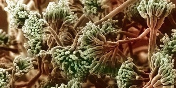'Antibiyotiğe 2 milyar yatırın yoksa yılda 10 milyon insan ölür'