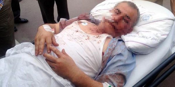 'Sivil polisim' dedi halk otob�s� �of�r�n� hastanelik etti