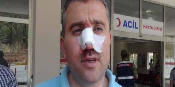 Şanlıurda'da sandık başkanı darp edildi