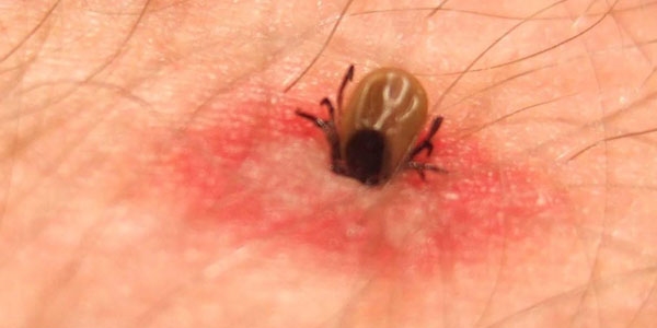 KKKA 12 y�lda 420 can ald�!