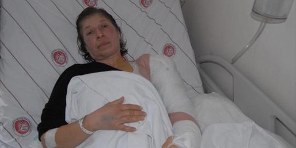 Göstericinin kolunu kıran polislere soruşturma izni çıkmadı