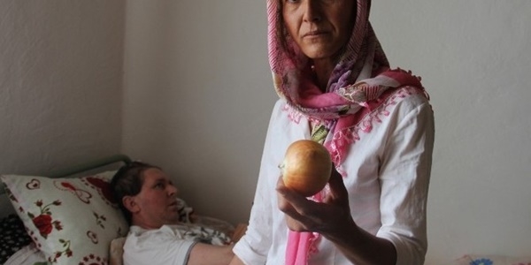 Ölecek diye taburcu edildi, 1 yıldır yaşıyor!