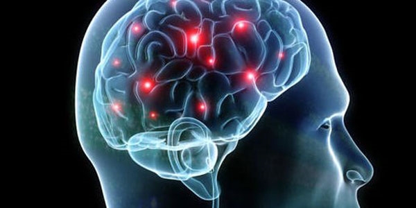 Alzheimer nasıl önlenir?