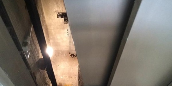 Asans�r facias�: 2 ya��ndaki �ocuk �ld�!