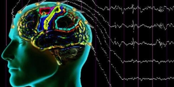 Türkiye'de 720 bin epilepsi hastası mevcut