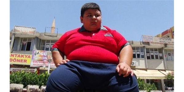 9 yaşında 91 kiloluk Muhammet'in dramı