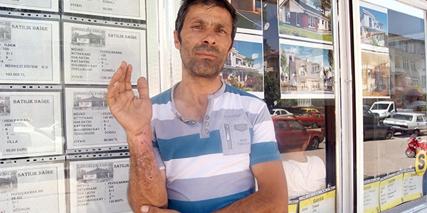 Marketten ald��� sigara b�re�i bomba gibi patlad�