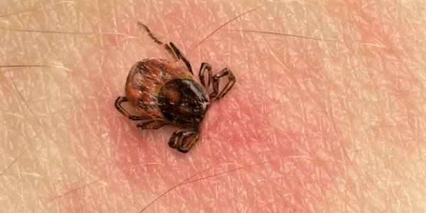 Kendisini �s�ran keneyi al�p hastaneye g�t�rd�