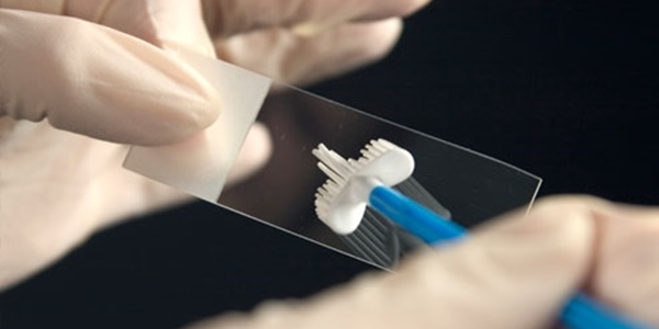 5 yılda bir HPV ve smear testi yaptırın!