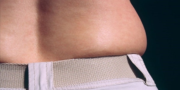 stenmeyen yalara souk etki