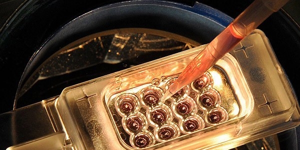 Trkiye tmre mdahalenin merkezi olacak