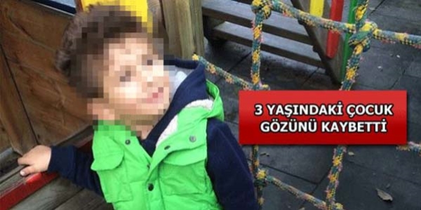 Restoranda çocuk yakan saldırgan; tezenin kocası