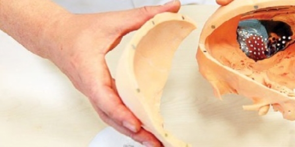 3D Teknolojisi ile vücudun yedek parçası üretiliyor