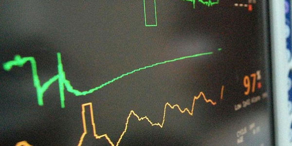 �� stresi kalp krizi riskini art�r�yor