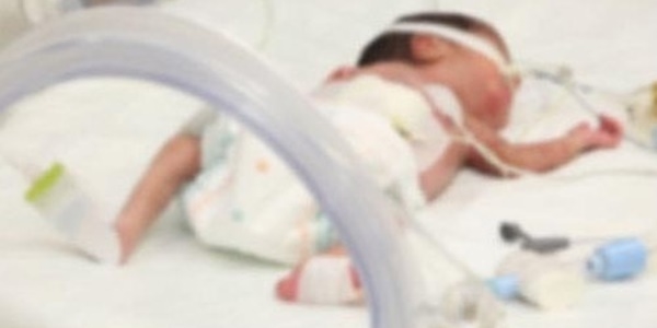 Hafta sonu doğan bebeklerin ölüm oranı daha yüksek