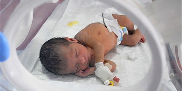 Her yıl 2,6 milyon bebek ölü doğuyor