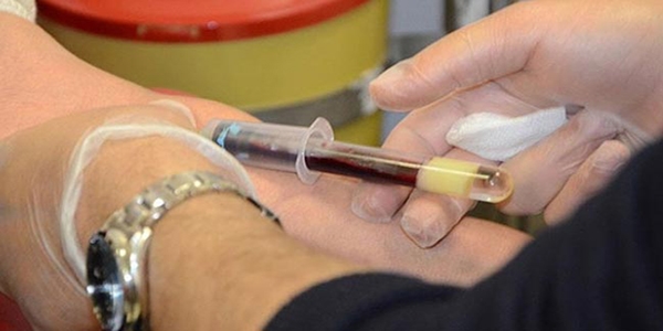 Ulusal kan alma kılavuzu hazırlandı