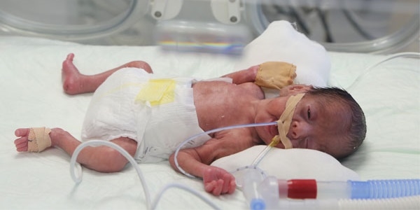 750 gram bebee operasyon