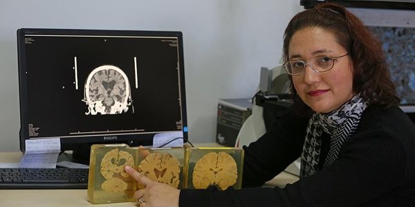 Beynin sırlarını çözmek için organ bağışı bekleniyor