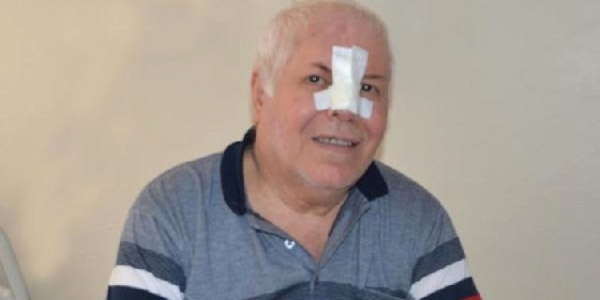 Yama ile burun tümöründen kurtuldu