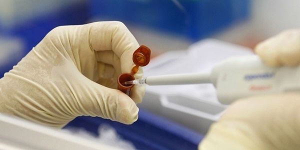 Şanlıurfa'da H1N1 şüphesiyle tedavi gören kişi öldü