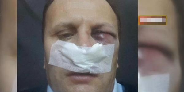 Küçükçekmece'de polisin gözüne taşla vurdular!