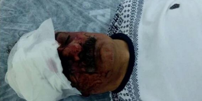 'HDP bizi kandırdı' diyen Kürt sanatçı darp edildi