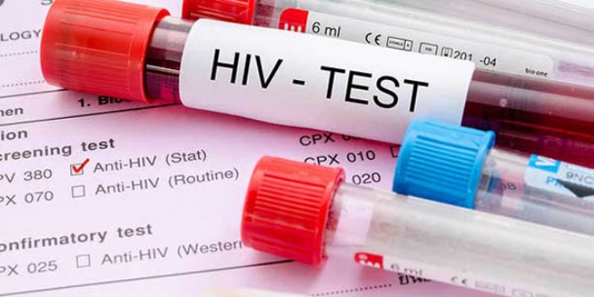'HIV virsnn tam anlamyla tedavisi bulunmuyor'