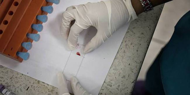 'Zika ile mikrosefali aras�nda g��l� ba� var'