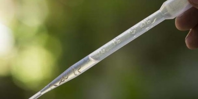 DSÖ: Zika aşısı 18 ay alabilir