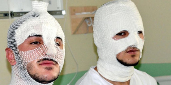 Parf�m s�kt�klar� otomobilin i�inde yand�lar