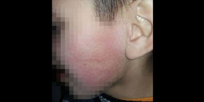 Engelli bak�mevinde dayak iddias�