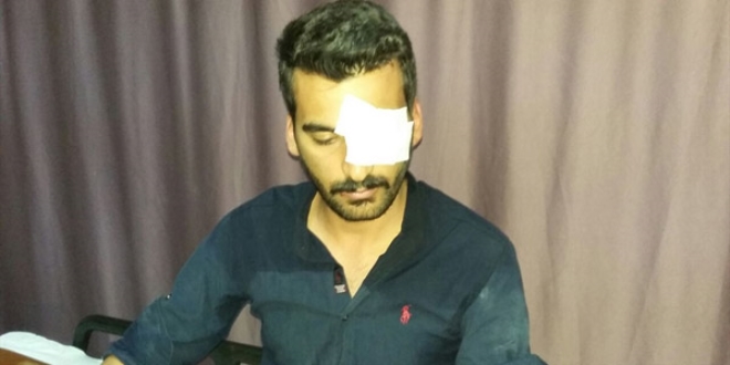 ASÜ'de 4 üniversite öğrencisi darp sonucu yaralandı