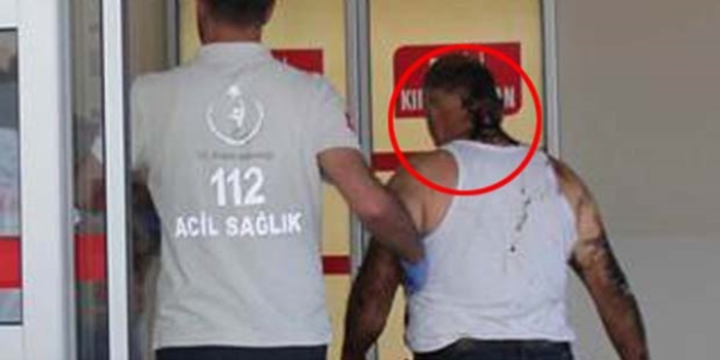Üzerlerine zift dökülen işçiler ağır yaralandı