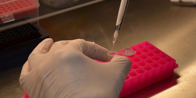 Türkiye'de 1,5 milyon kadına HPV-DNA taraması