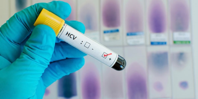 FDA, Hepatit C i�in ilk ila� kombinasyonunu onaylad�