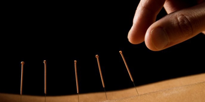 'Depresyon tedavisine akupuntur ile destek'