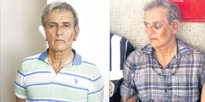 Akın Öztürk'ün yüzündeki 2 gün farkı