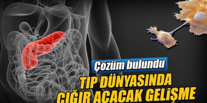 Pankreas kanserine yan etkisiz ilaç