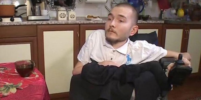 Dünyada ilk kez kafa nakli yapılacak