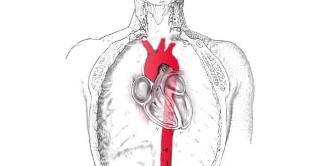 Bu kadar salam aort damar nasl yrtlr?