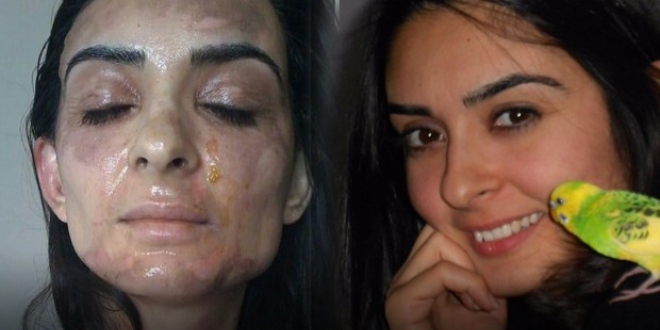 D�d�kl� tencere bomba gibi patlad�