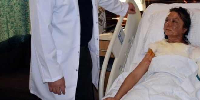 Uyuyan gelininin üzerine kızgın yağ döktü