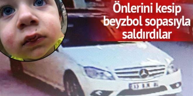 �ehir magandalar�ndan beyzbol sopal� sald�r�