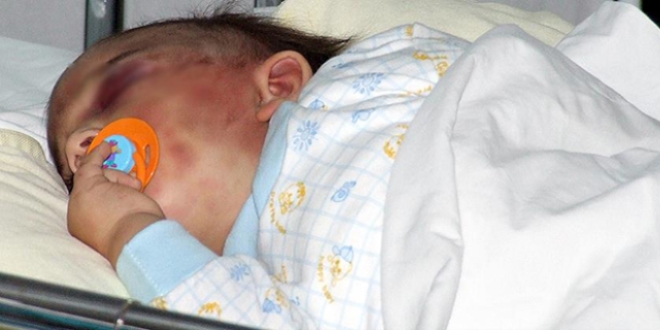 'Bebe�i �iddetle sarsmak �l�me neden olabilir'