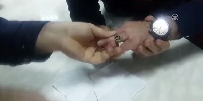 Parmağına sıkışan yüzüğü itfaiye ekipleri çıkarttı