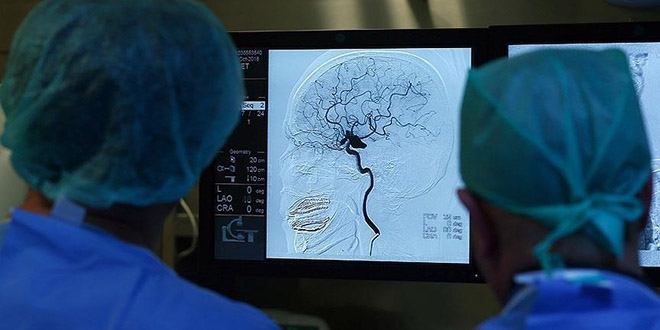 Derin beyin uyar�m�, anoreksiya tedavisi i�in umut olabilir