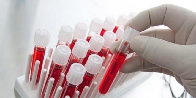 Kan testi yumurtal�k kanserinin erken te�hisine yard�mc� oluyor