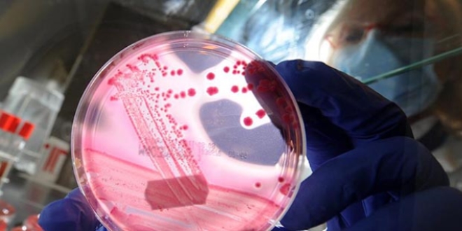 Bakterilerin antibiyotik direncini krmann yolu bulundu